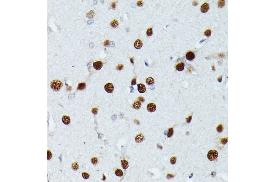Immunohistochemistry - Anti-MEF2C Antibody (A14085) - Antibodies.com