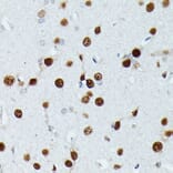 Immunohistochemistry - Anti-MEF2C Antibody (A14085) - Antibodies.com