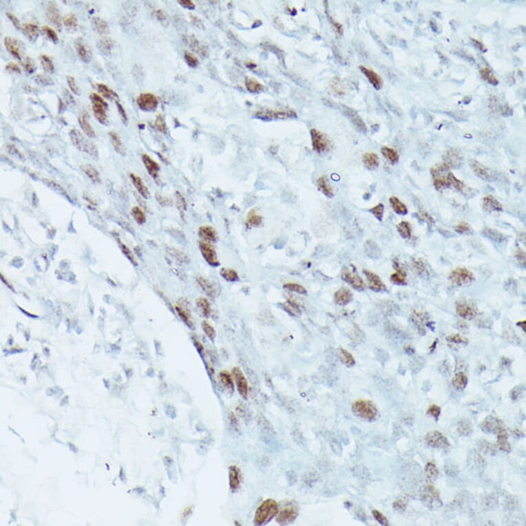 Immunohistochemistry - Anti-MEF2C Antibody (A14085) - Antibodies.com