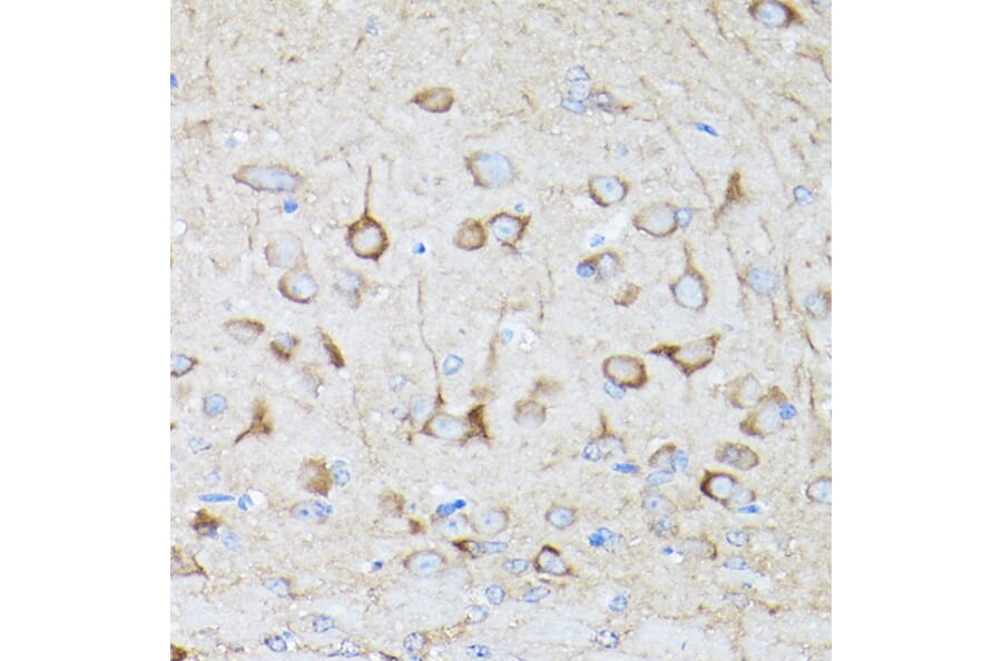 Immunohistochemistry - Anti-DRP1 Antibody (A14086) - Antibodies.com