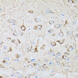 Immunohistochemistry - Anti-DRP1 Antibody (A14086) - Antibodies.com