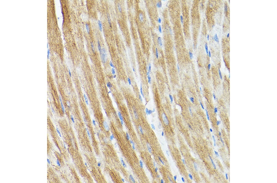 Immunohistochemistry - Anti-DRP1 Antibody (A14086) - Antibodies.com