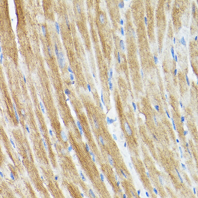 Immunohistochemistry - Anti-DRP1 Antibody (A14086) - Antibodies.com