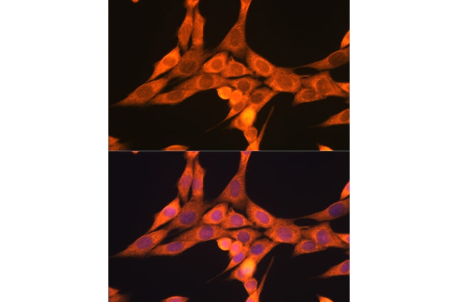 Immunofluorescence - Anti-DRP1 Antibody (A14086) - Antibodies.com