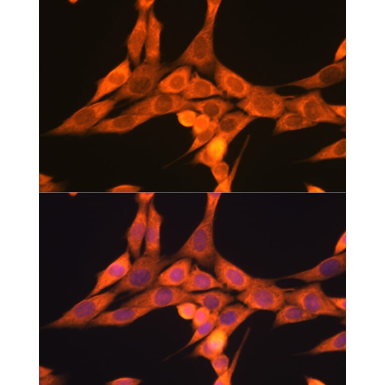 Immunofluorescence - Anti-DRP1 Antibody (A14086) - Antibodies.com