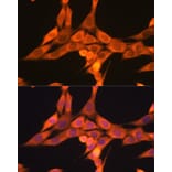 Immunofluorescence - Anti-DRP1 Antibody (A14086) - Antibodies.com