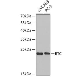 Western Blot - Anti-BTC Antibody (A14087) - Antibodies.com