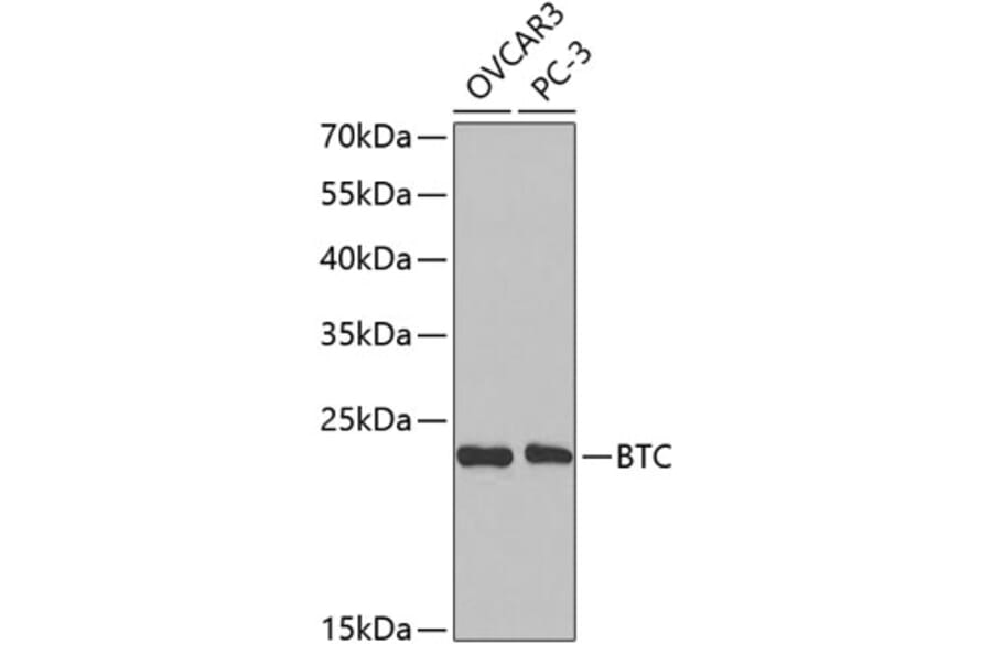 Western Blot - Anti-BTC Antibody (A14087) - Antibodies.com