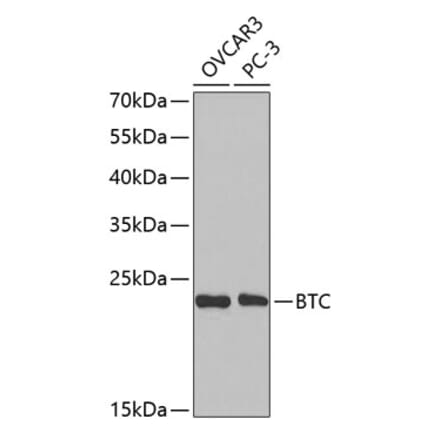 Western Blot - Anti-BTC Antibody (A14087) - Antibodies.com