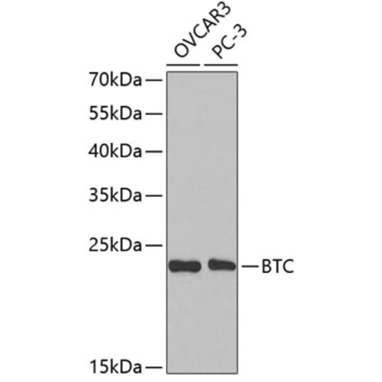 Western Blot - Anti-BTC Antibody (A14087) - Antibodies.com