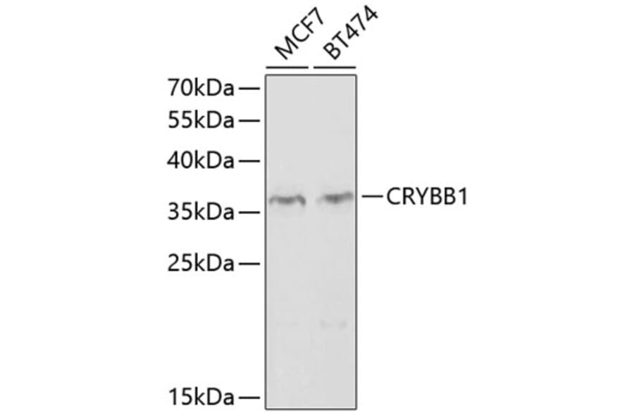 Western Blot - Anti-CRYBB1 Antibody (A2590) - Antibodies.com