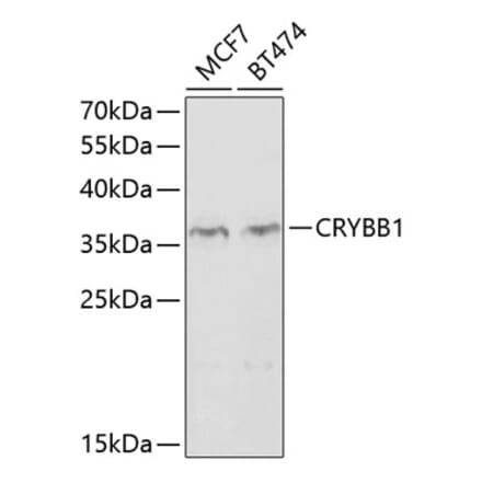 Western Blot - Anti-CRYBB1 Antibody (A14089) - Antibodies.com
