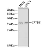 Western Blot - Anti-CRYBB1 Antibody (A2590) - Antibodies.com