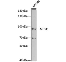 Western Blot - Anti-MUSK Antibody (A2591) - Antibodies.com