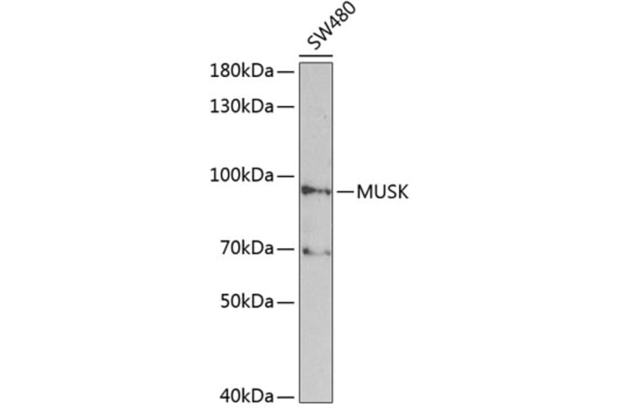 Western Blot - Anti-MUSK Antibody (A2591) - Antibodies.com
