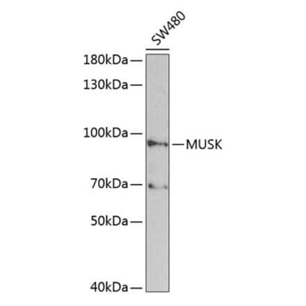 Western Blot - Anti-MUSK Antibody (A2591) - Antibodies.com