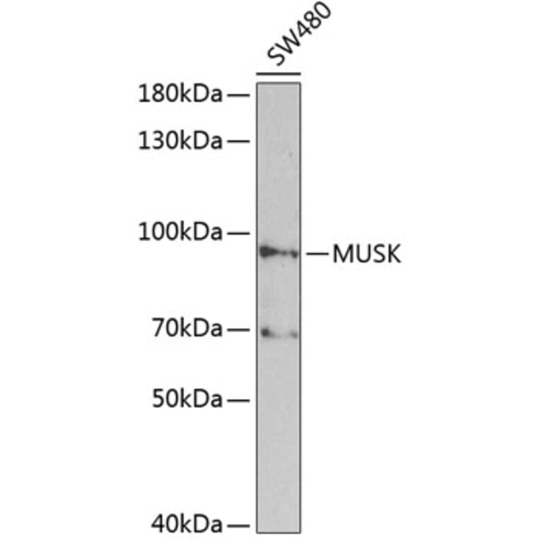 Western Blot - Anti-MUSK Antibody (A2591) - Antibodies.com