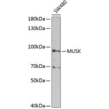 Western Blot - Anti-MUSK Antibody (A2591) - Antibodies.com