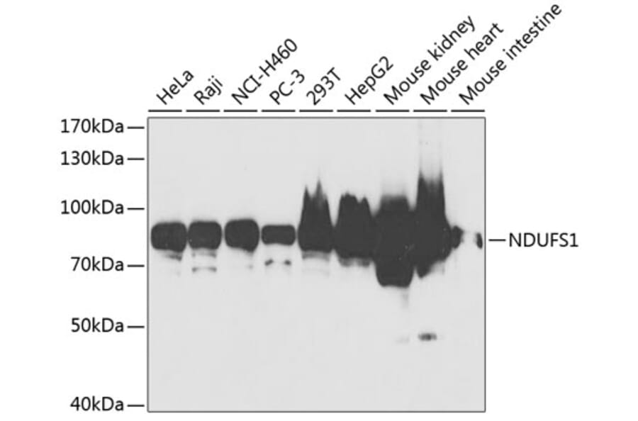 Western Blot - Anti-NDUFS1 Antibody (A2592) - Antibodies.com
