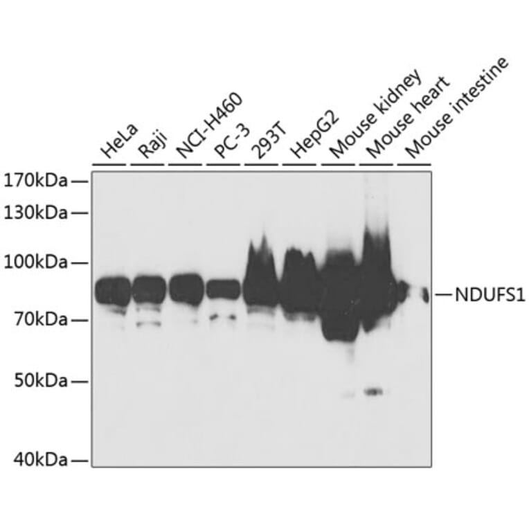 Western Blot - Anti-NDUFS1 Antibody (A2592) - Antibodies.com