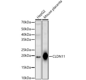 Western Blot - Anti-Oligodendrocyte Specific Protein Antibody (A14092) - Antibodies.com