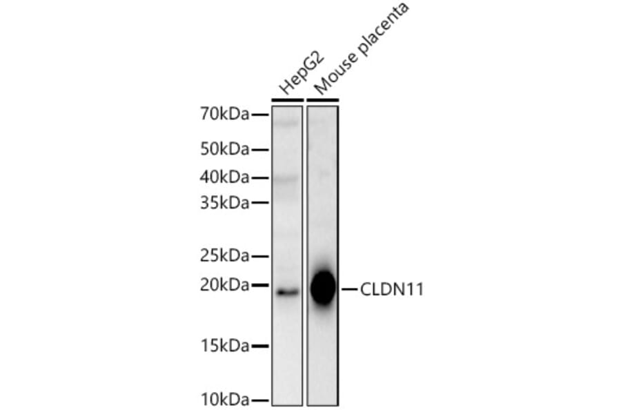 Western Blot - Anti-Oligodendrocyte Specific Protein Antibody (A14092) - Antibodies.com