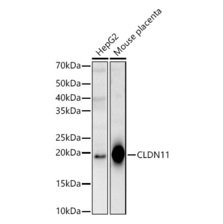 Western Blot - Anti-Oligodendrocyte Specific Protein Antibody (A14092) - Antibodies.com