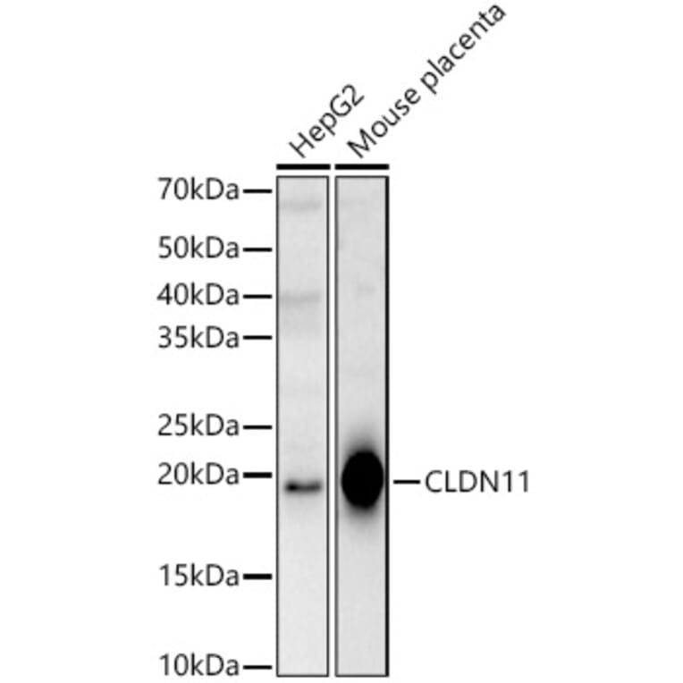 Western Blot - Anti-Oligodendrocyte Specific Protein Antibody (A14092) - Antibodies.com