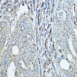 Immunohistochemistry - Anti-SDHA Antibody (A14093) - Antibodies.com