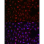 Immunofluorescence - Anti-SDHA Antibody (A14093) - Antibodies.com