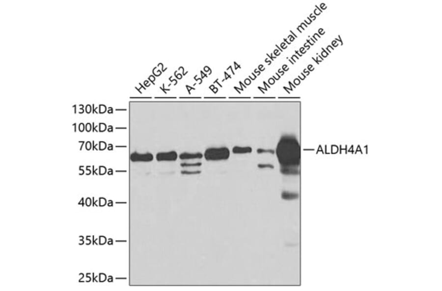 Western Blot - Anti-ALDH4A1/P5CDH Antibody (A14094) - Antibodies.com