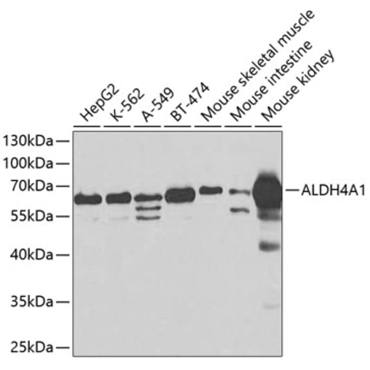 Western Blot - Anti-ALDH4A1/P5CDH Antibody (A14094) - Antibodies.com
