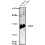 Western Blot - Anti-CCL28 Antibody (A14095) - Antibodies.com