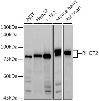 Western blot analysis of extracts of rat liver, using Anti-RHOT2 Antibody (A2597) at 1:1,000 dilution.
Secondary antibody: Goat Anti-Rabbit IgG (H+L) (HRP) (AS014) at 1:10,000 dilution.
Lysates / proteins: 25µg per lane.
Blocking buffer: 3% non-fat dry milk in TBST.
Detection: ECL Basic Kit (RM00020).
Exposure time: 90s.