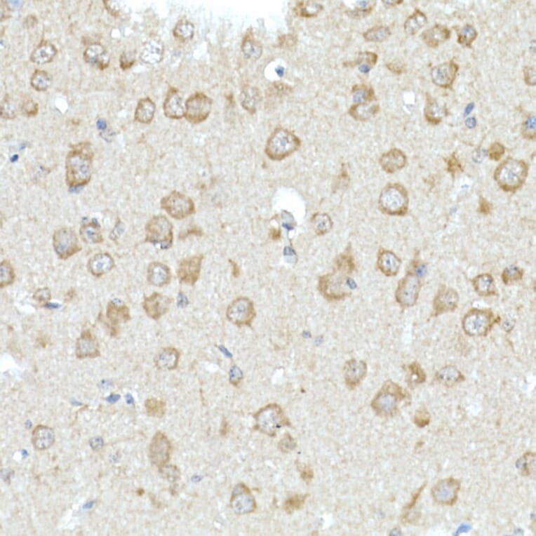 Immunohistochemistry - Anti-MIRO2 Antibody (A14096) - Antibodies.com