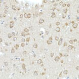 Immunohistochemistry - Anti-MIRO2 Antibody (A14096) - Antibodies.com