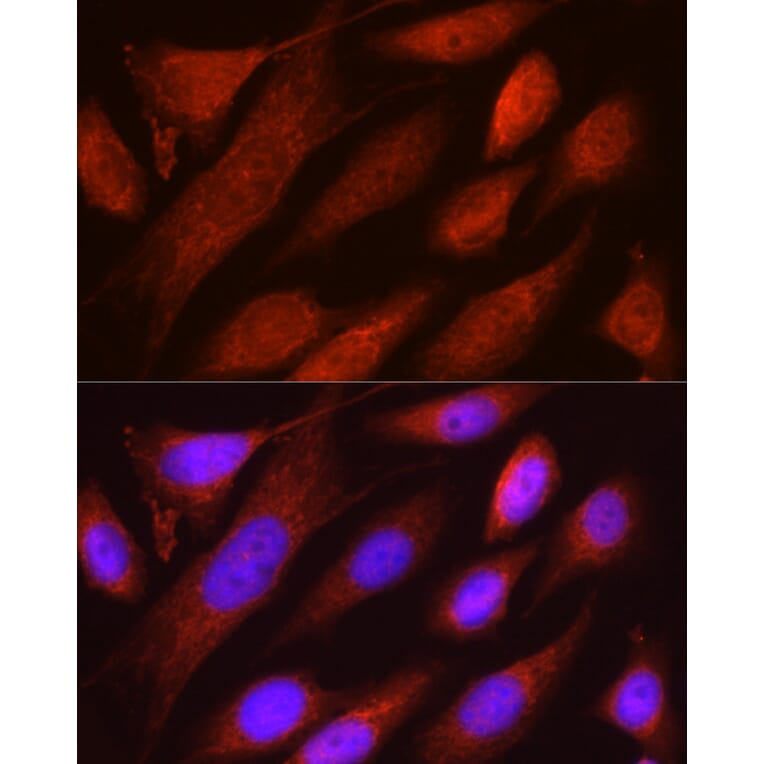 Immunofluorescence - Anti-MIRO2 Antibody (A14096) - Antibodies.com