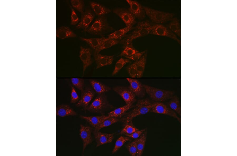 Immunofluorescence - Anti-ATG4A Antibody (A14097) - Antibodies.com