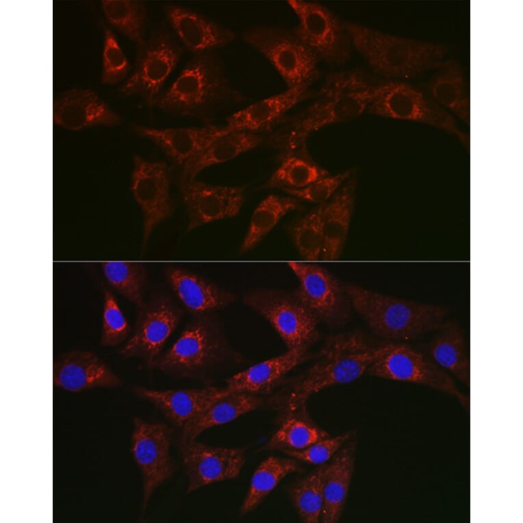 Immunofluorescence - Anti-ATG4A Antibody (A14097) - Antibodies.com