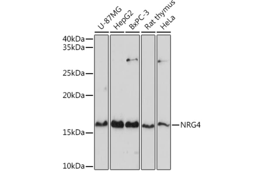 Western Blot - Anti-NRG4 Antibody (A14098) - Antibodies.com