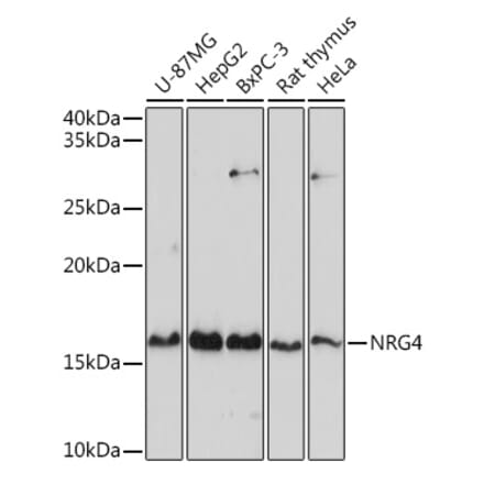 Western Blot - Anti-NRG4 Antibody (A14098) - Antibodies.com