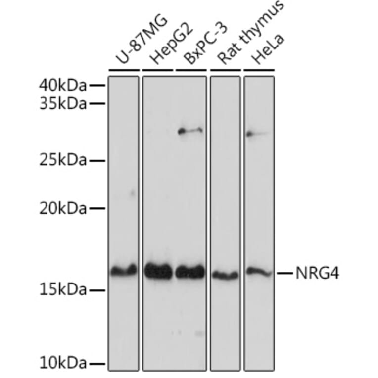 Western Blot - Anti-NRG4 Antibody (A14098) - Antibodies.com