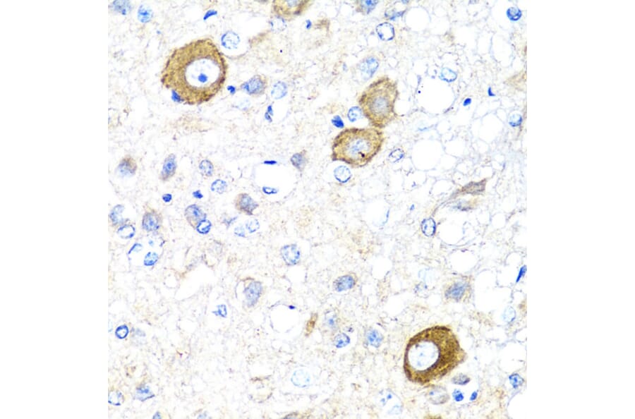 Immunohistochemistry - Anti-NRG4 Antibody (A14098) - Antibodies.com