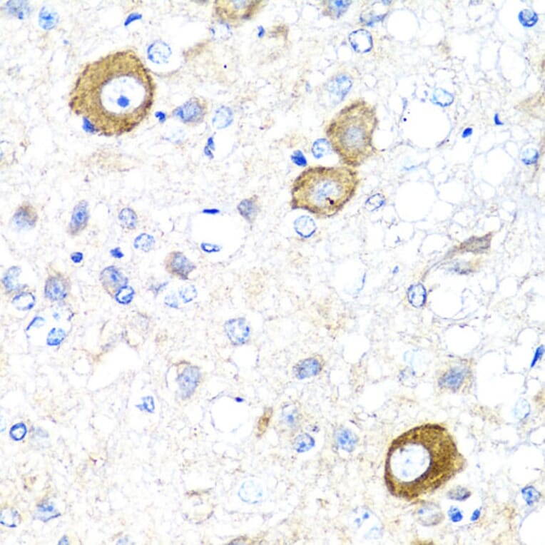 Immunohistochemistry - Anti-NRG4 Antibody (A14098) - Antibodies.com