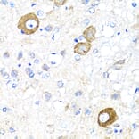 Immunohistochemistry - Anti-NRG4 Antibody (A14098) - Antibodies.com