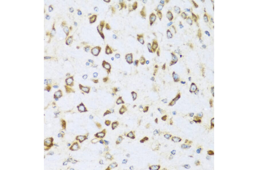 Immunohistochemistry - Anti-NRG4 Antibody (A14098) - Antibodies.com