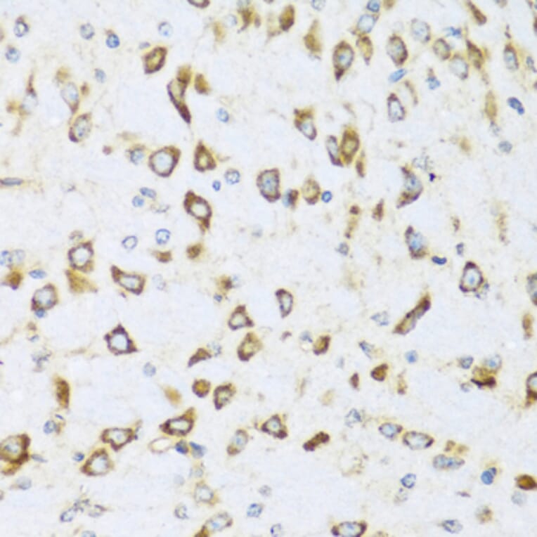 Immunohistochemistry - Anti-NRG4 Antibody (A14098) - Antibodies.com