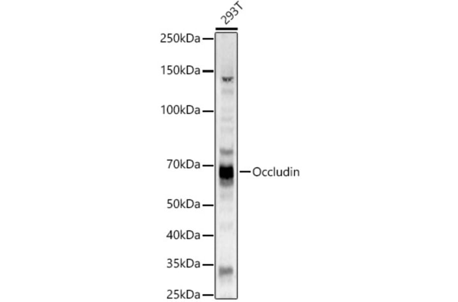 Western Blot - Anti-Occludin Antibody (A14099) - Antibodies.com