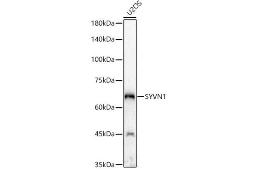 Western Blot - Anti-SYVN1/HRD1 Antibody (A14100) - Antibodies.com