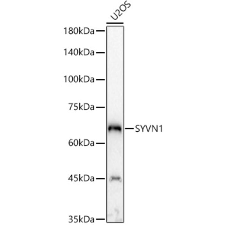 Western Blot - Anti-SYVN1/HRD1 Antibody (A14100) - Antibodies.com